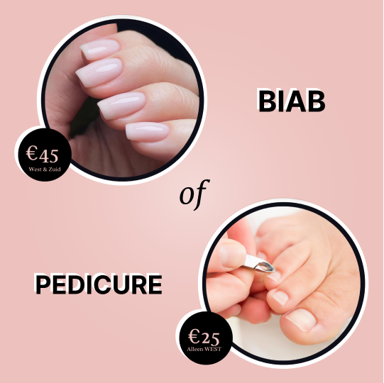 Lente deals banner